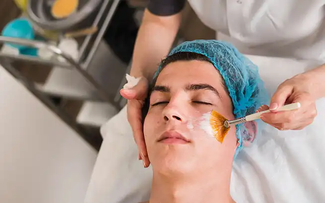 what is a chemical peel