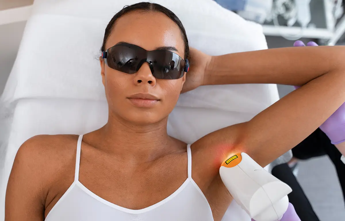 tips and tricks to laser hair removal for dark skin