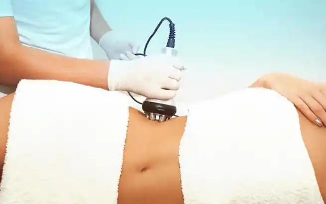 What is a Sculpsure?