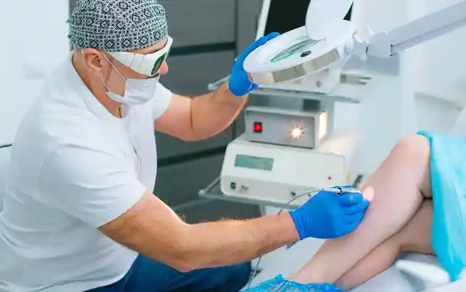 Factors for Selecting the Laser Vein Removal Center