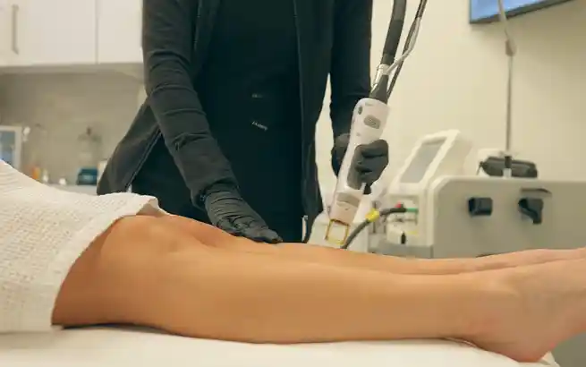 What Is a Vein Removal Center?